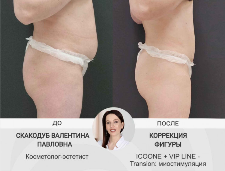 Массаж частные объявления электрогорск